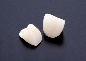 オールセラミッククラウン